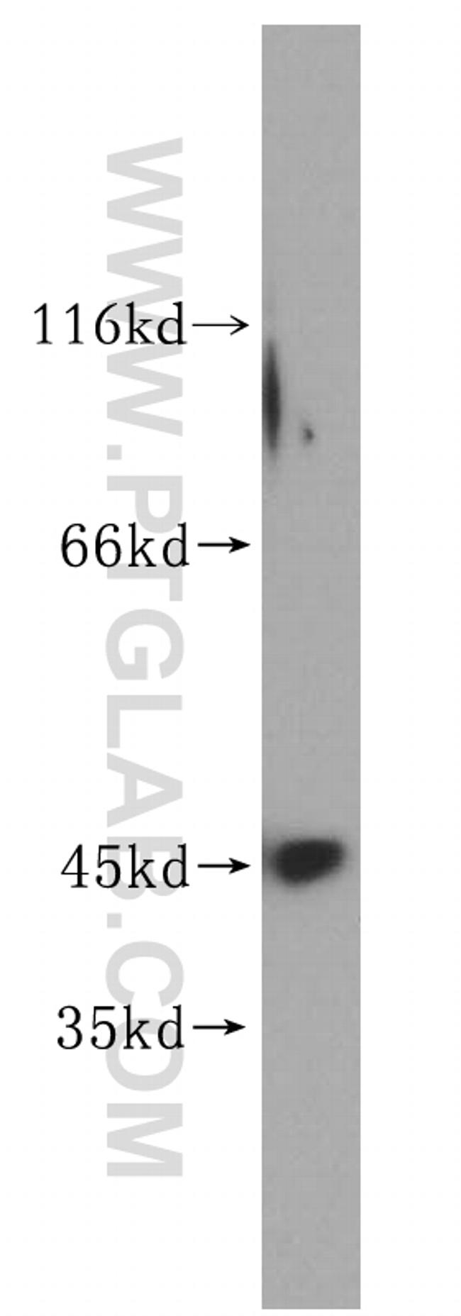 UBE2Z Antibody in Western Blot (WB)