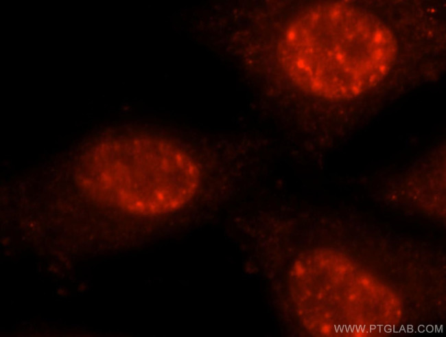 PRPF40B Antibody in Immunocytochemistry (ICC/IF)