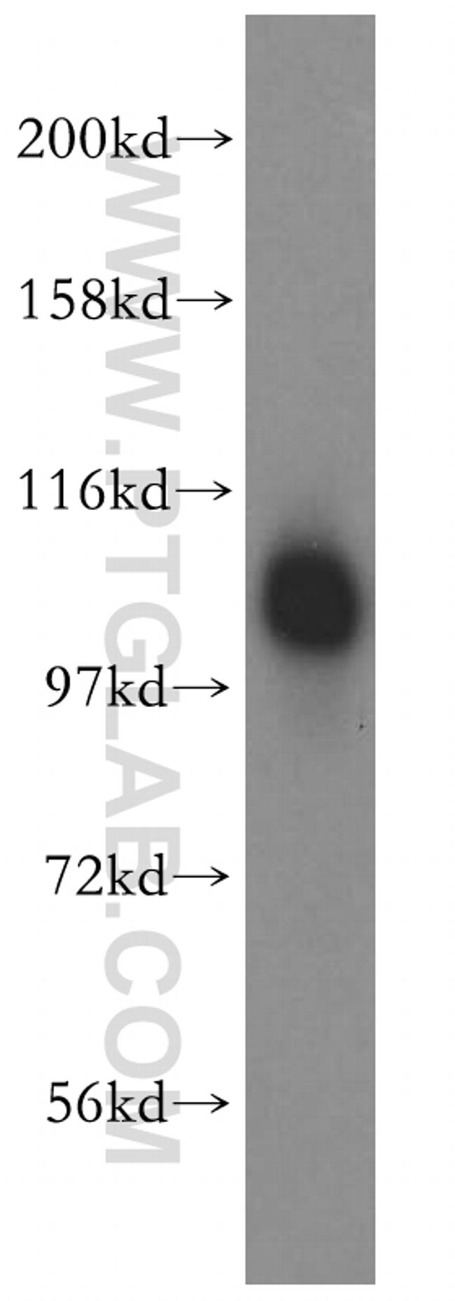 FAM29A Antibody in Western Blot (WB)