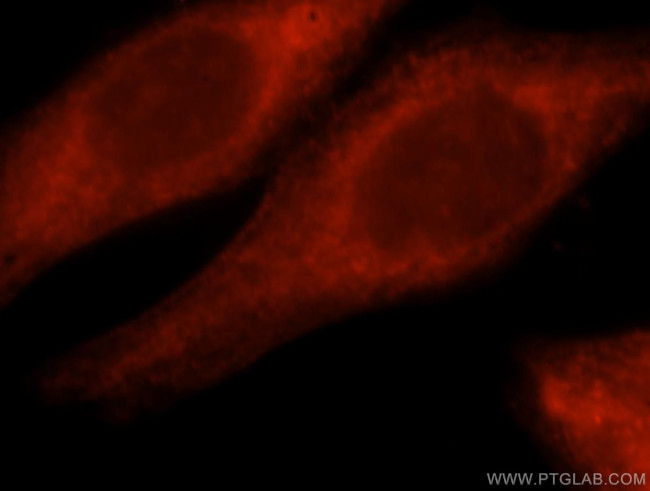 RNF10 Antibody in Immunocytochemistry (ICC/IF)