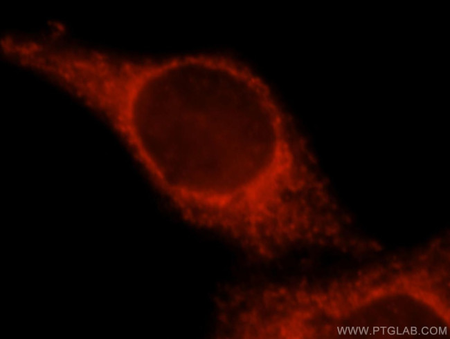 SPATS2L Antibody in Immunocytochemistry (ICC/IF)