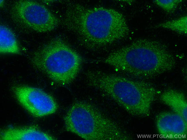 GAPVD1 Antibody in Immunocytochemistry (ICC/IF)