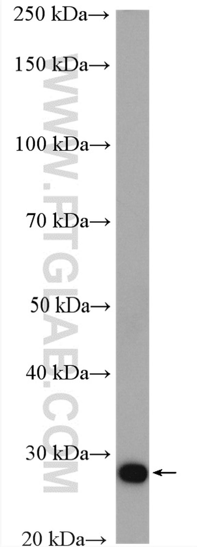 MOBKL2A Antibody in Western Blot (WB)