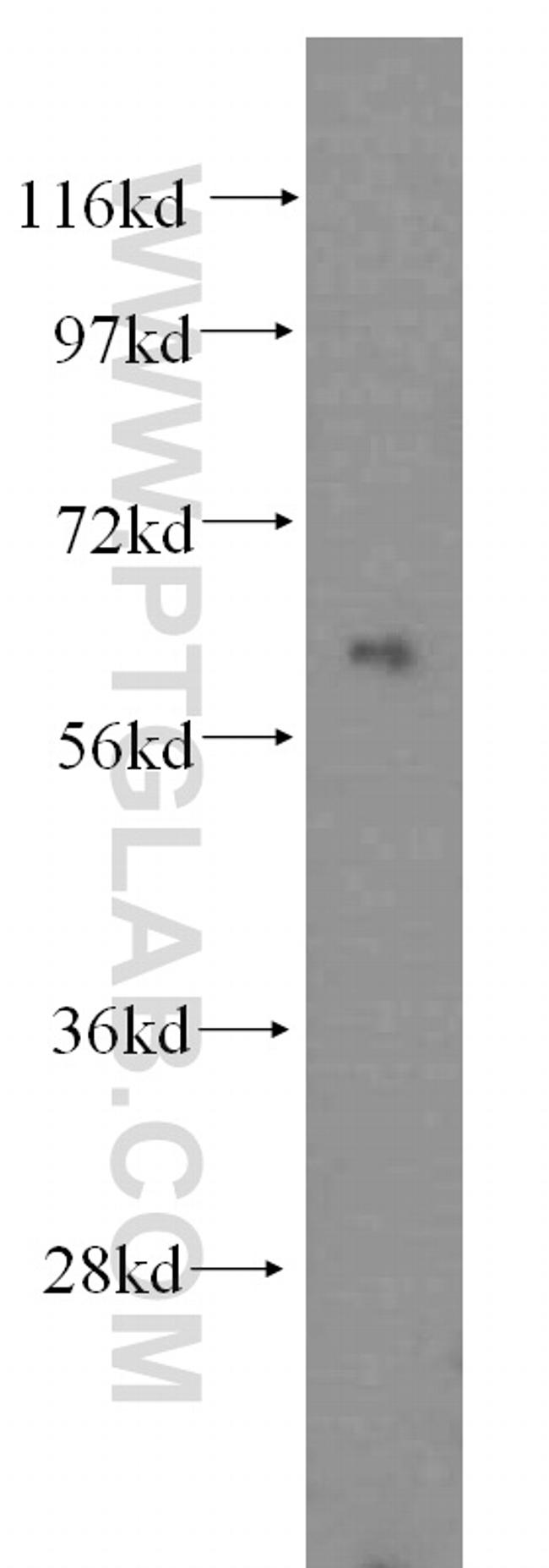 PARP6 Antibody in Western Blot (WB)
