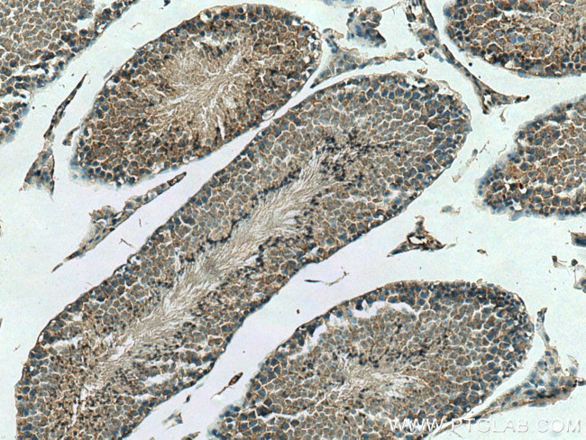 DCTN6 Antibody in Immunohistochemistry (Paraffin) (IHC (P))