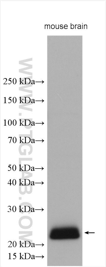 CPLX3 Antibody in Western Blot (WB)