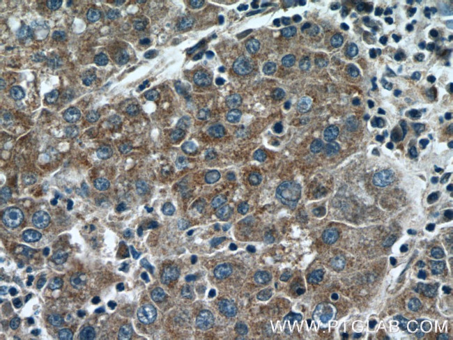 KLHL21 Antibody in Immunohistochemistry (Paraffin) (IHC (P))