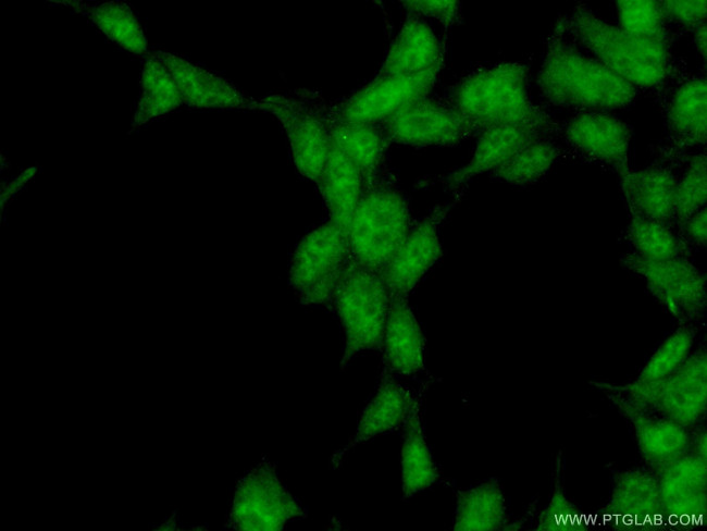 SYF2 Antibody in Immunocytochemistry (ICC/IF)
