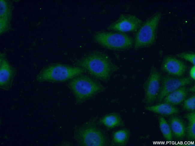 Connexin-26 Antibody in Immunocytochemistry (ICC/IF)