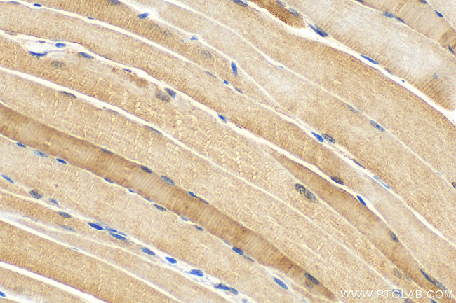 MYL6B Antibody in Immunohistochemistry (Paraffin) (IHC (P))