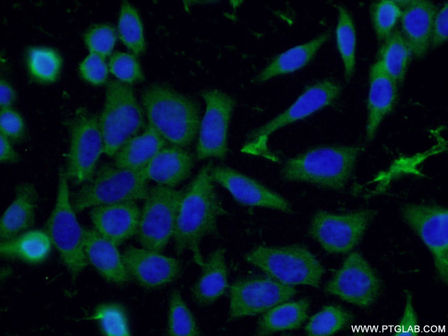 Syntabulin Antibody in Immunocytochemistry (ICC/IF)