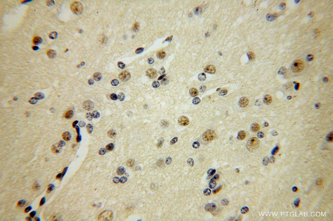 FANCC Antibody in Immunohistochemistry (Paraffin) (IHC (P))
