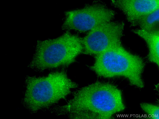 METTL2B Antibody in Immunocytochemistry (ICC/IF)