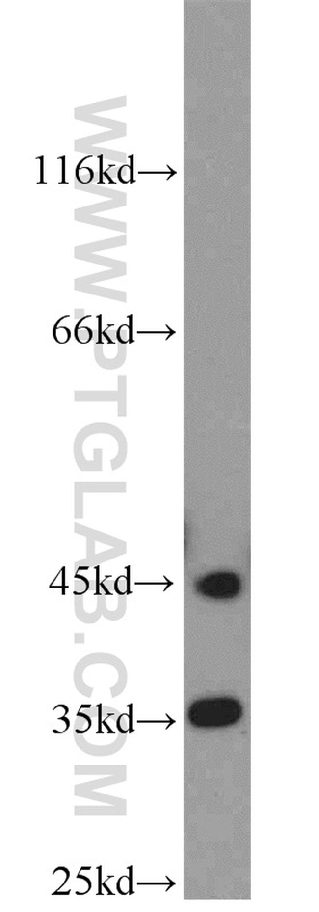 PHYHIP Antibody in Western Blot (WB)