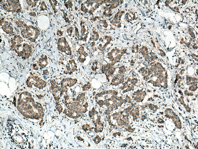HSDL1 Antibody in Immunohistochemistry (Paraffin) (IHC (P))