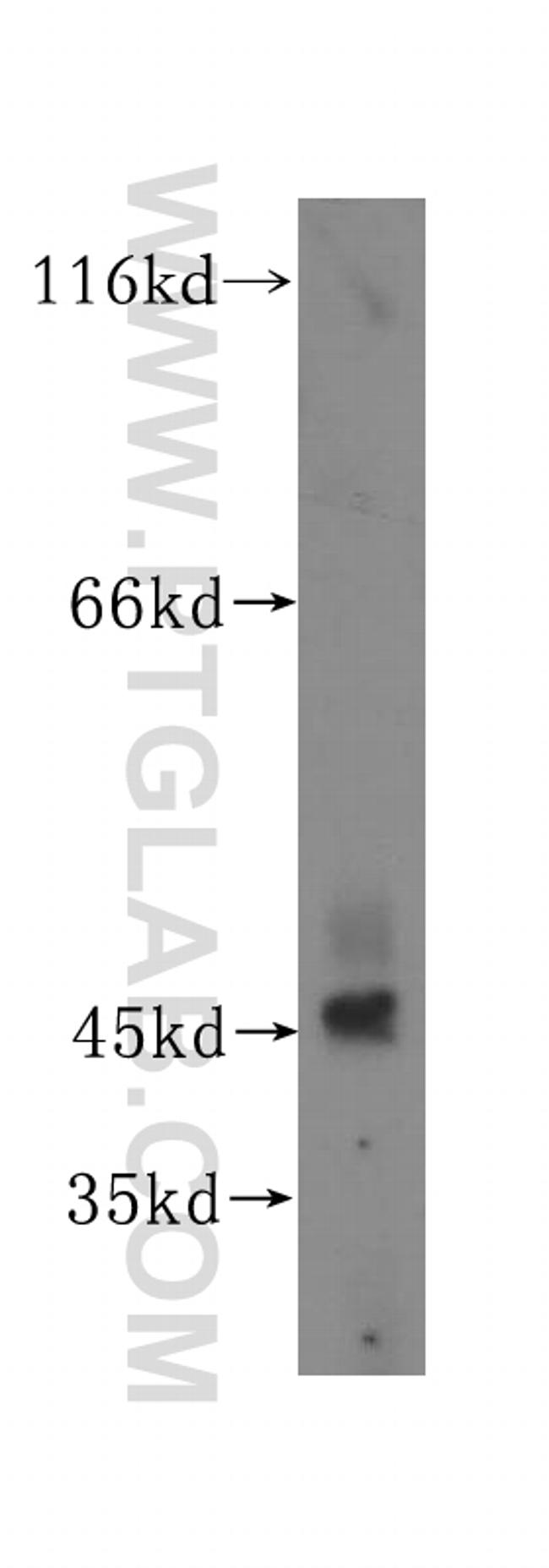 TEX28 Antibody in Western Blot (WB)