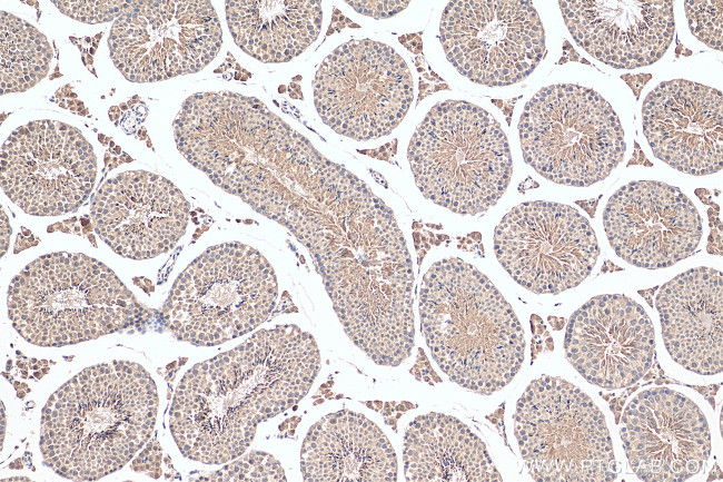 SCAPER Antibody in Immunohistochemistry (Paraffin) (IHC (P))
