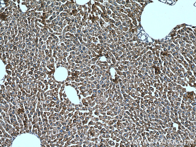 METTL7B Antibody in Immunohistochemistry (Paraffin) (IHC (P))