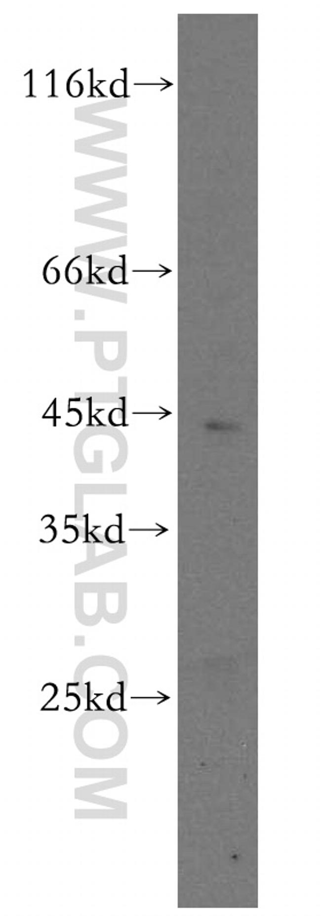 CENPL Antibody in Western Blot (WB)