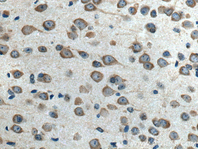 ELP3 Antibody in Immunohistochemistry (Paraffin) (IHC (P))