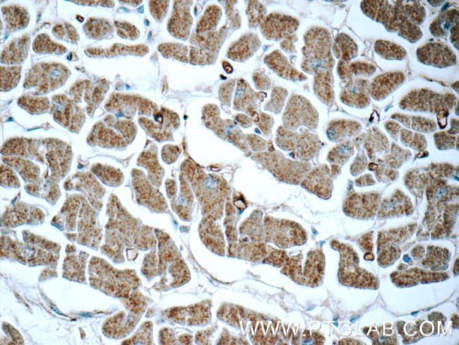 APCDD1 Antibody in Immunohistochemistry (Paraffin) (IHC (P))