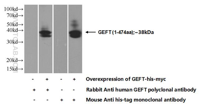 GEFT Antibody in Western Blot (WB)