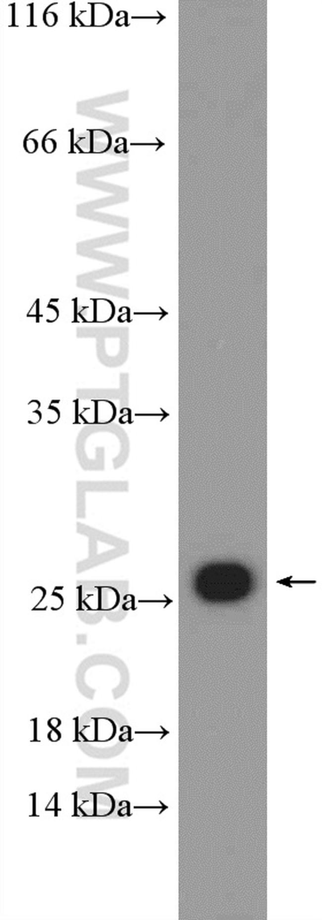 RPL18 Antibody in Western Blot (WB)