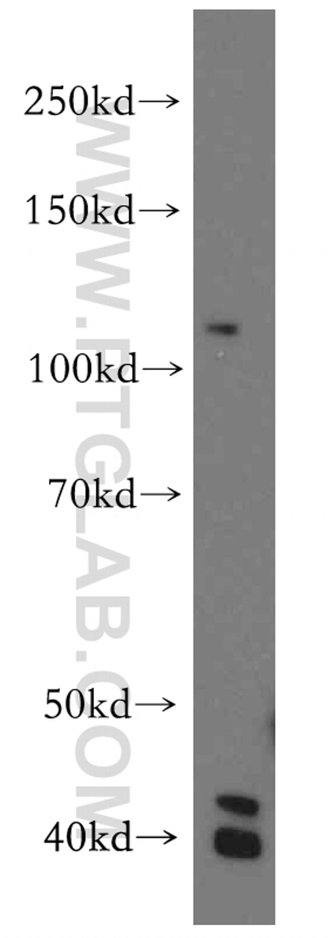 H2AFY2 Antibody in Western Blot (WB)
