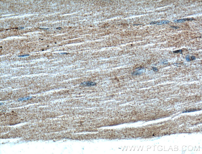 GRK5 Antibody in Immunohistochemistry (Paraffin) (IHC (P))