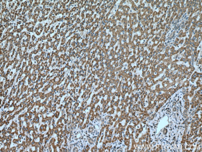 MUT Antibody in Immunohistochemistry (Paraffin) (IHC (P))