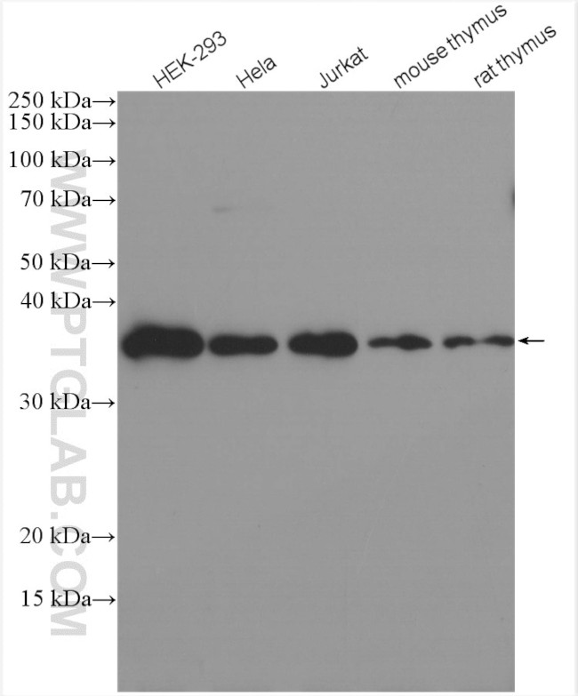 RWDD1 Antibody in Western Blot (WB)