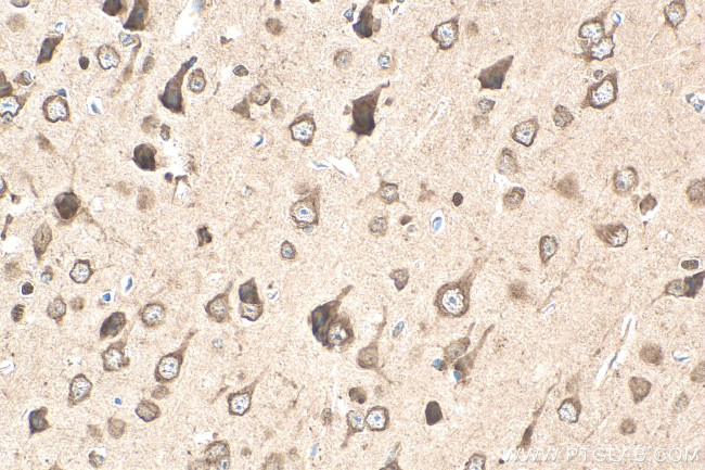 AGXT2L1 Antibody in Immunohistochemistry (Paraffin) (IHC (P))