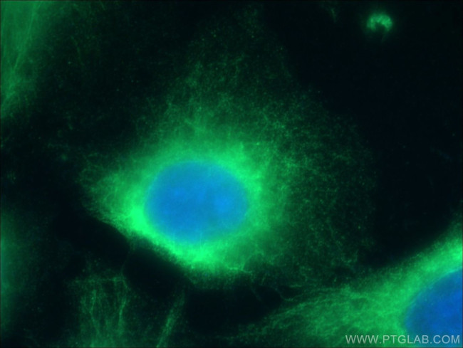 CLIP4 Antibody in Immunocytochemistry (ICC/IF)
