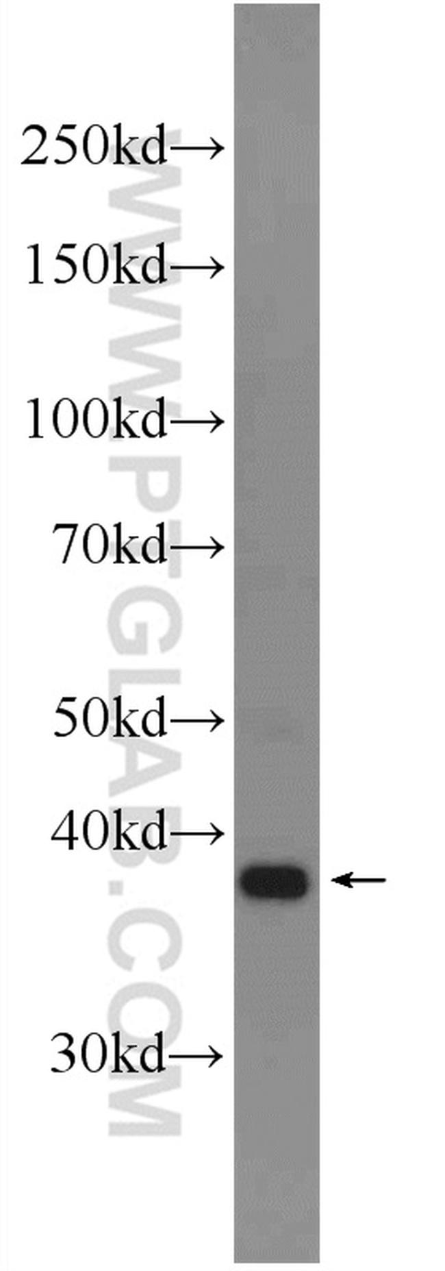 DPPA4 Antibody in Western Blot (WB)