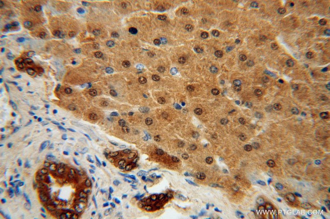 STARD10 Antibody in Immunohistochemistry (Paraffin) (IHC (P))
