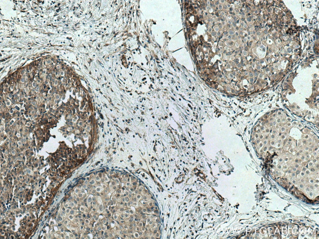 LATS1 Antibody in Immunohistochemistry (Paraffin) (IHC (P))