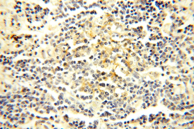 TEKT4 Antibody in Immunohistochemistry (Paraffin) (IHC (P))