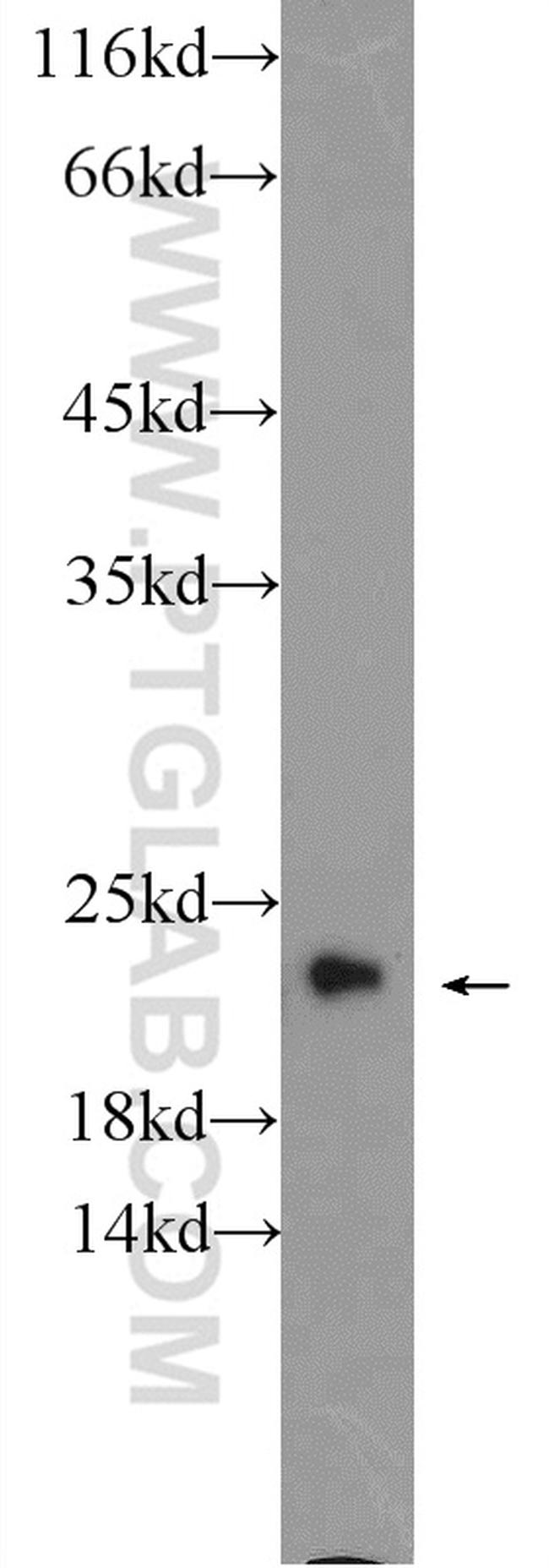 ARL8A Antibody in Western Blot (WB)