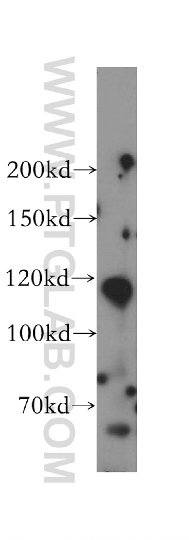 PMFBP1 Antibody in Western Blot (WB)
