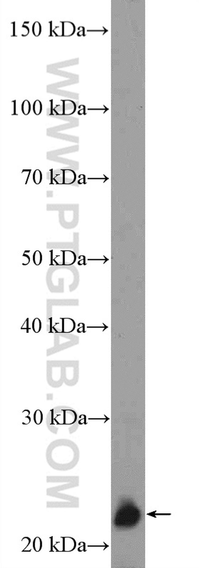 ZNF22 Antibody in Western Blot (WB)