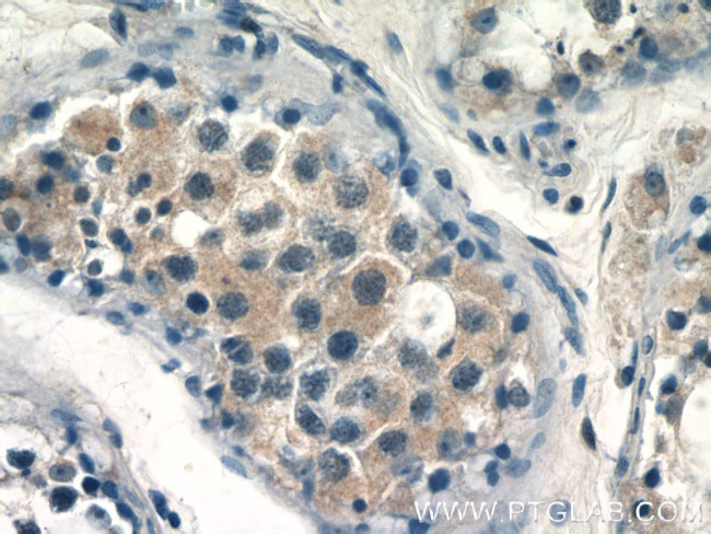 CALR3 Antibody in Immunohistochemistry (Paraffin) (IHC (P))