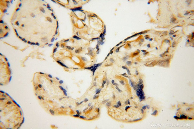 SLFNL1 Antibody in Immunohistochemistry (Paraffin) (IHC (P))