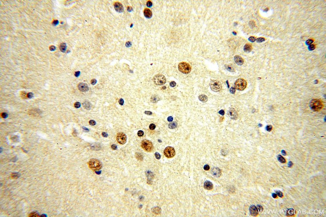 ZNF18 Antibody in Immunohistochemistry (Paraffin) (IHC (P))