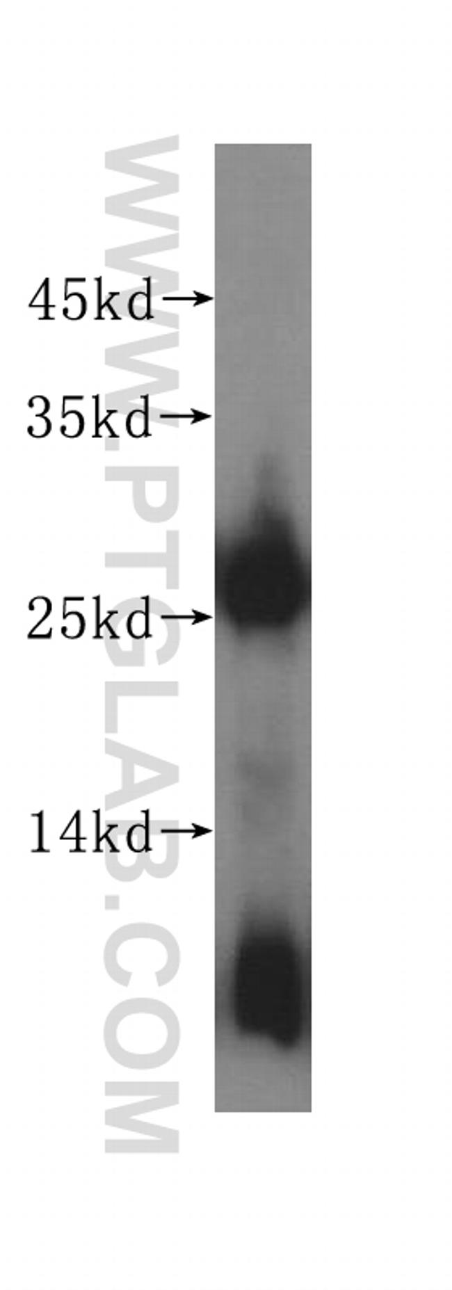 DNAJB8 Antibody in Western Blot (WB)