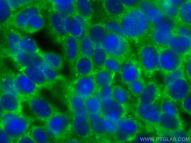 KATNAL2 Antibody in Immunocytochemistry (ICC/IF)