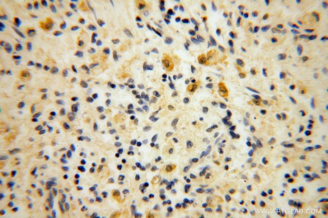 PDLIM7 Antibody in Immunohistochemistry (Paraffin) (IHC (P))
