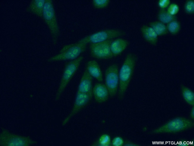 DDX27 Antibody in Immunocytochemistry (ICC/IF)