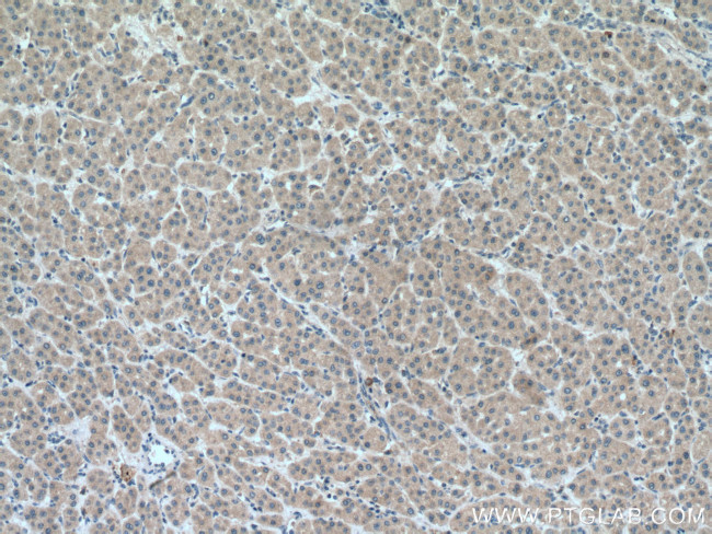 METTL7A Antibody in Immunohistochemistry (Paraffin) (IHC (P))