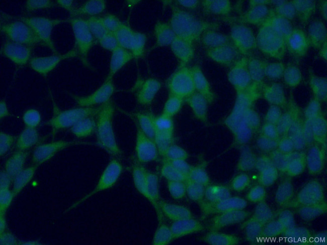SPHK2 Antibody in Immunocytochemistry (ICC/IF)