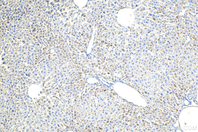 DGAT2 Antibody in Immunohistochemistry (Paraffin) (IHC (P))